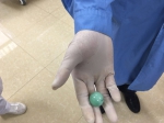 7岁男孩玻璃球卡喉危在旦夕环环相扣接力救援转危为安 - 卫生厅