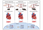 生命学院田维明课题组揭示Krüppel样转录因子7（Klf7）调控心脏糖脂代谢平衡参与心肌肥厚发病新机制 - 哈尔滨工业大学